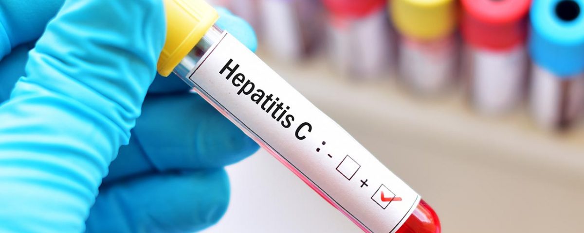 Hepatitis C Cases Are On the Rise in Massachusetts