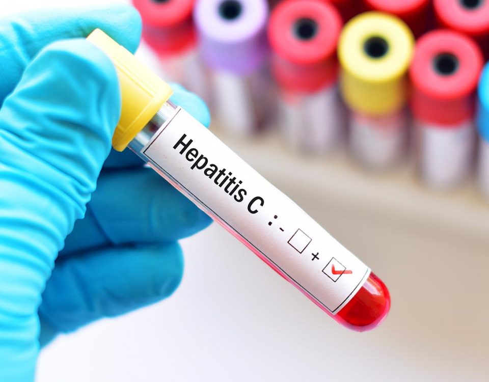 Hepatitis C Cases Are On the Rise in Massachusetts