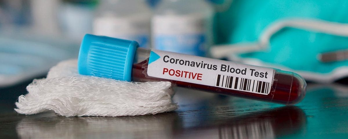 Avoid the Coronavirus with Rehab