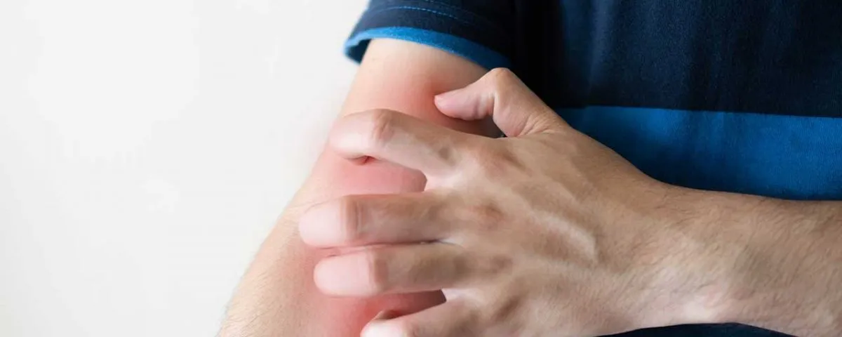 How to Stop Itching From Narcotics